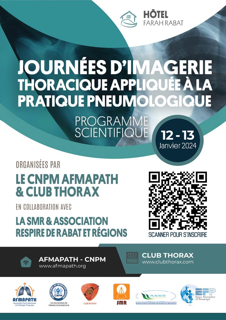 Journée d'imagerie thoracique appliquée à la pratique pneumologique